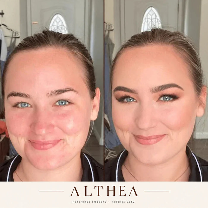 Before and after Althea, reference imagery