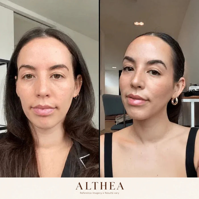 Before and after Althea, reference imagery